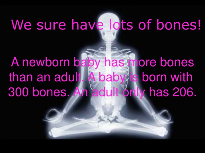 we sure have lots of bones