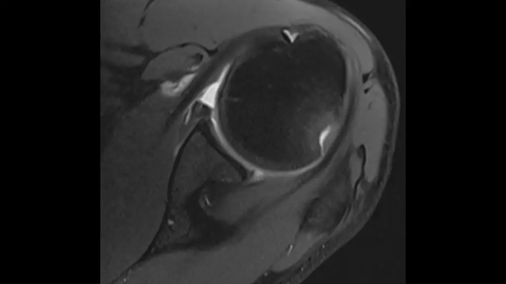 slide8