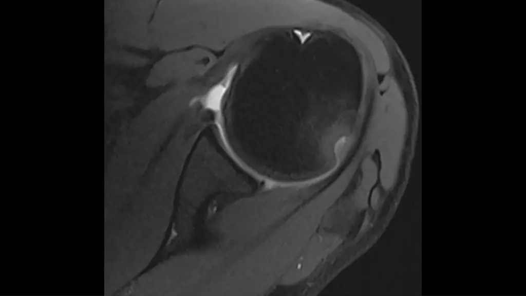 slide9