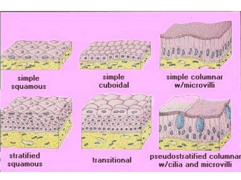 slide11