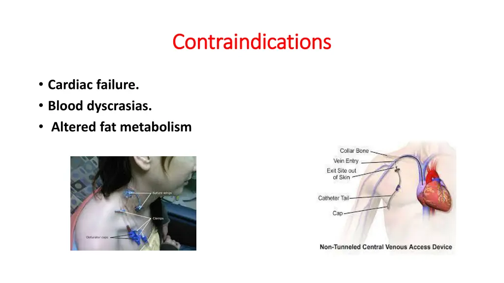 contraindications contraindications 1