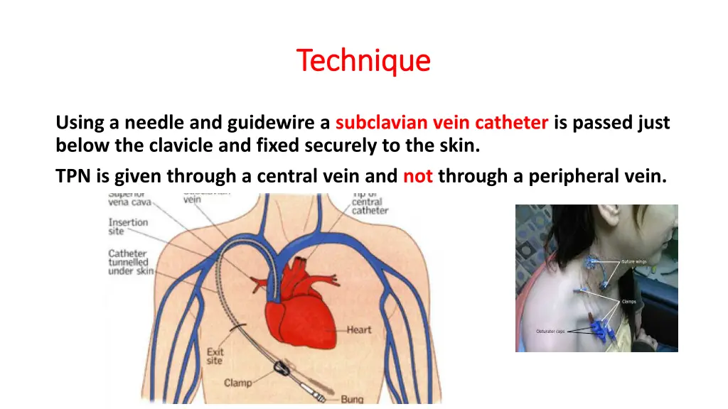 technique technique