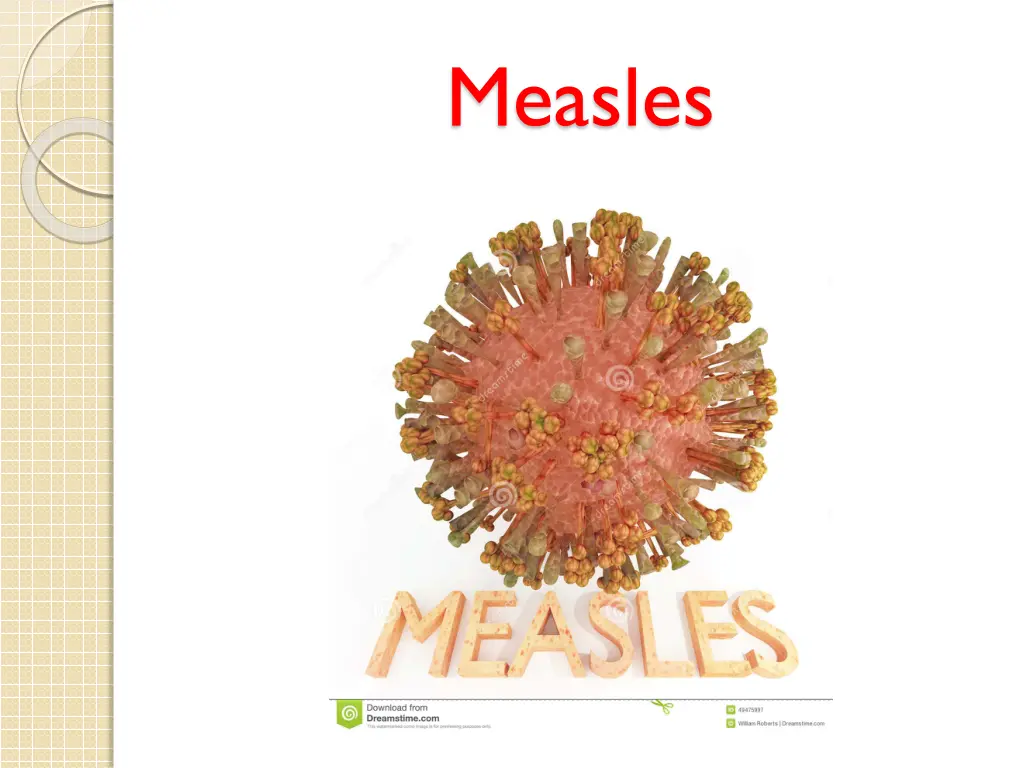 measles