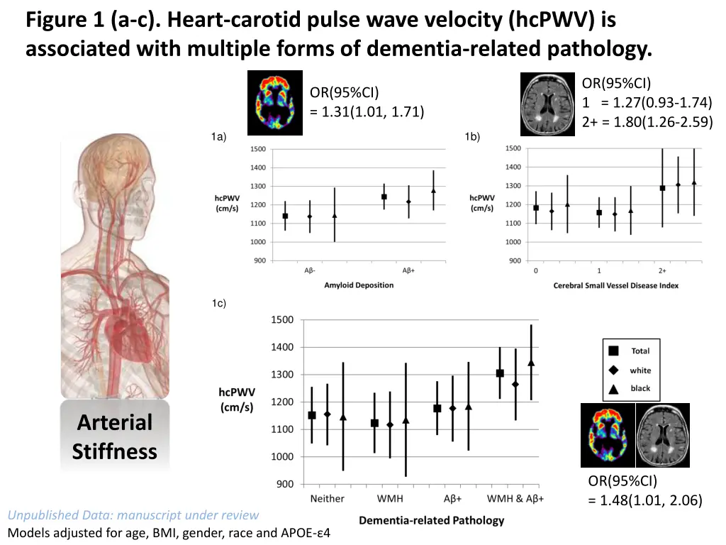figure 1 a c heart carotid pulse wave velocity