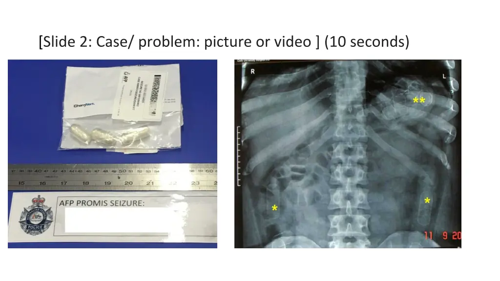 slide 2 case problem picture or video 10 seconds 1