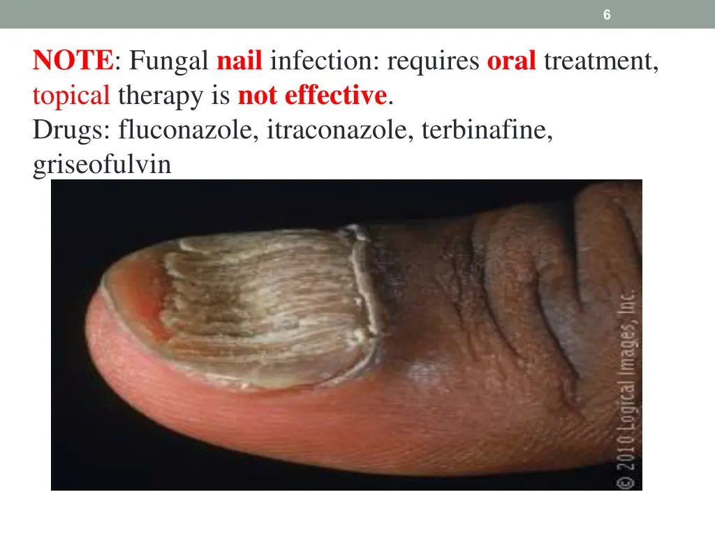 slide6