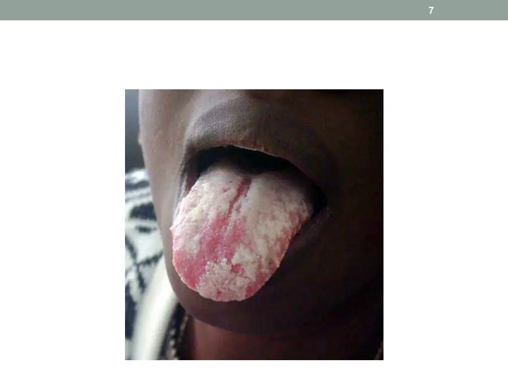 slide7