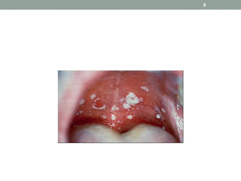 slide8