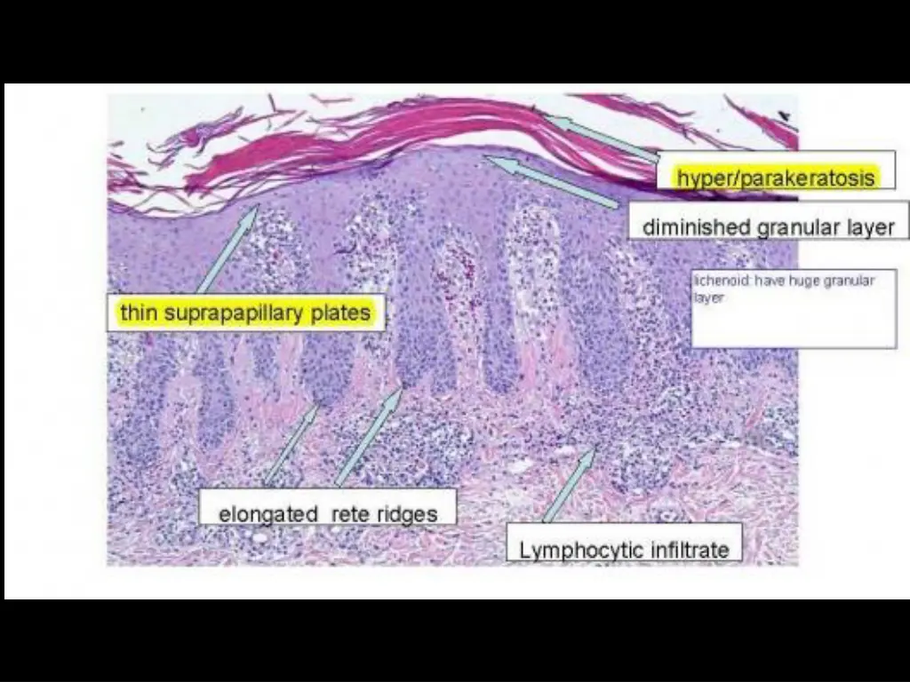 slide37