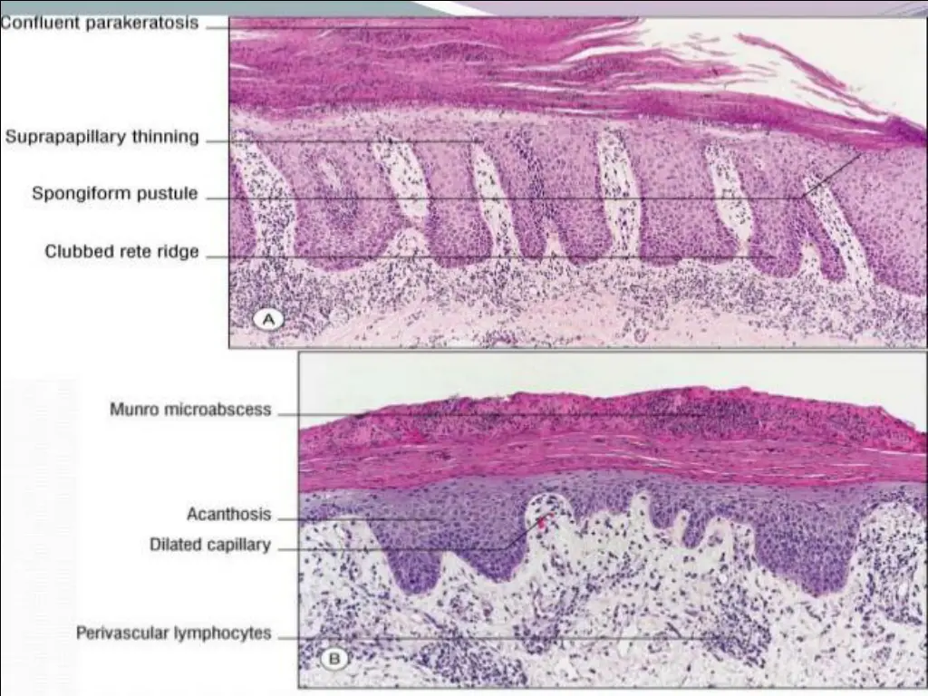slide38