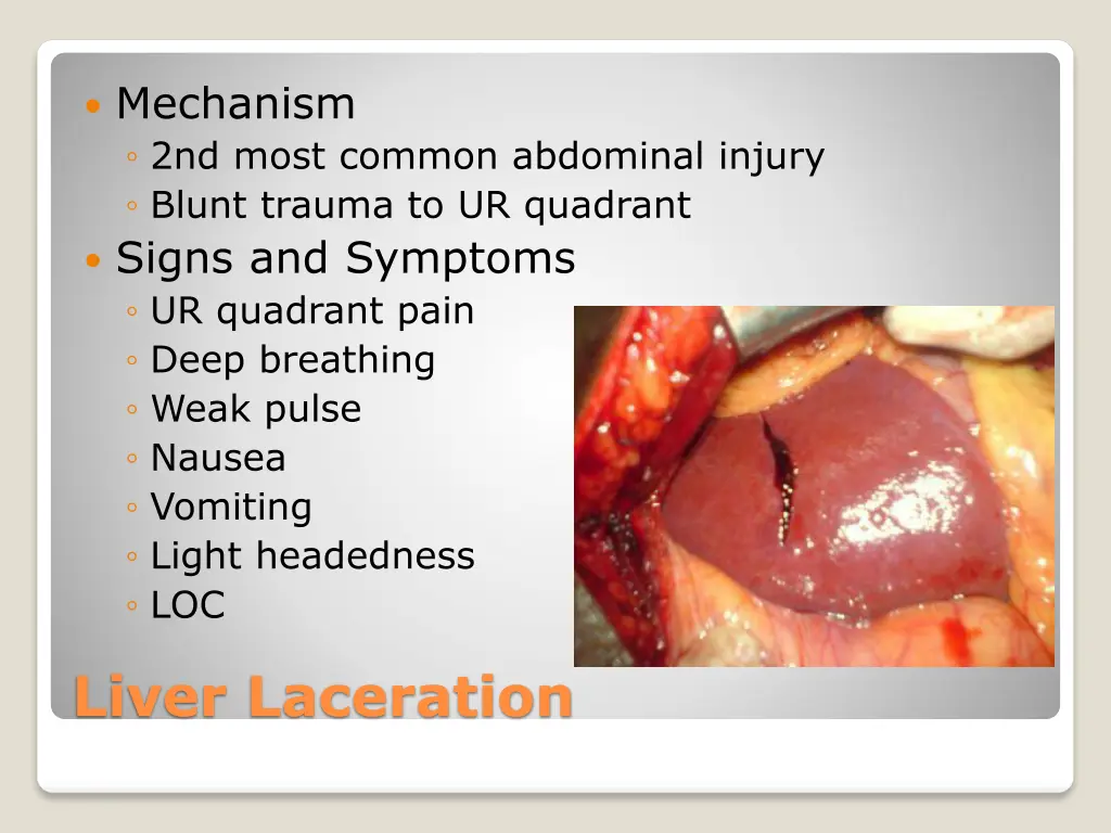 mechanism 2nd most common abdominal injury blunt
