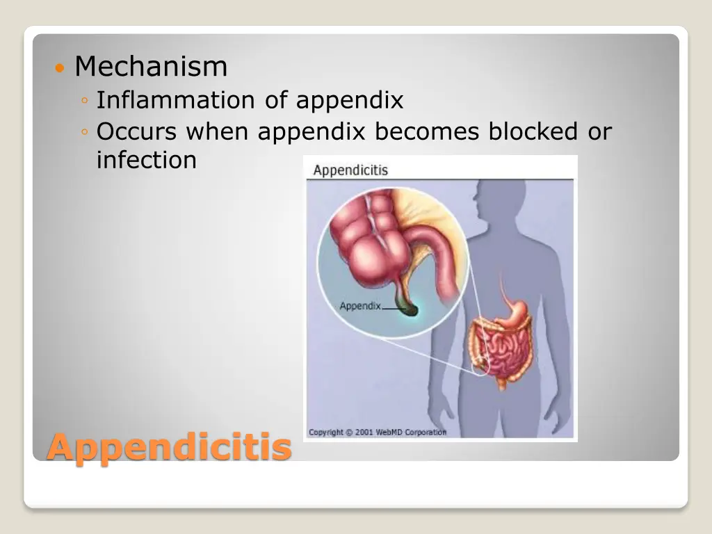 mechanism inflammation of appendix occurs when