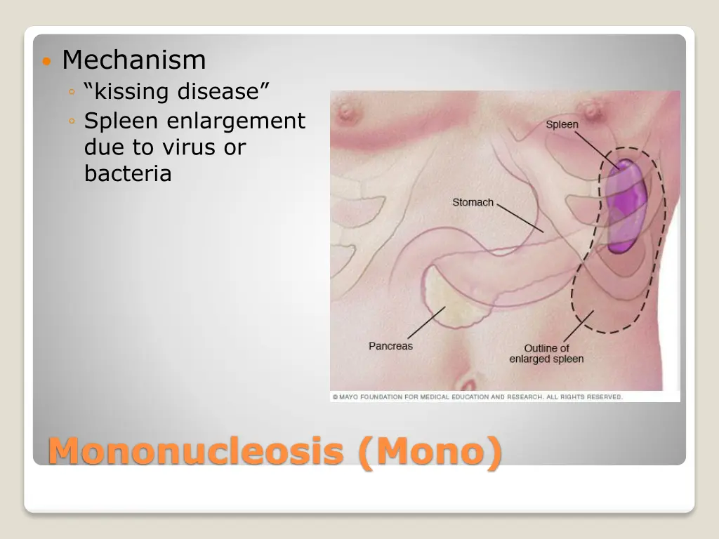 mechanism kissing disease spleen enlargement
