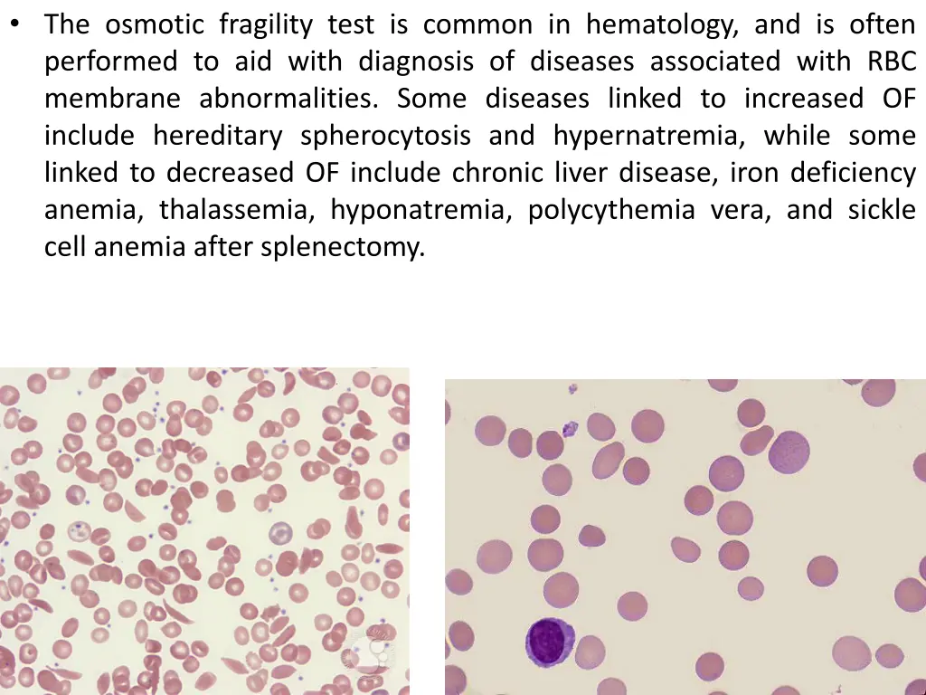 the osmotic fragility test is common