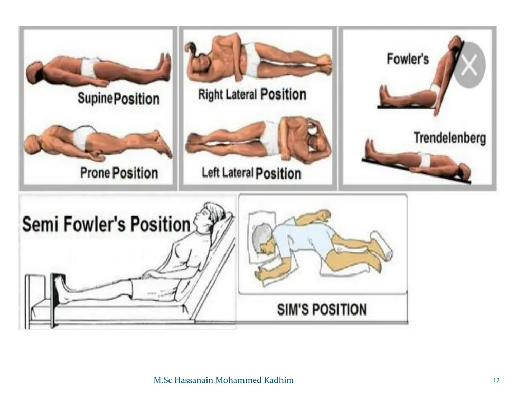 slide12