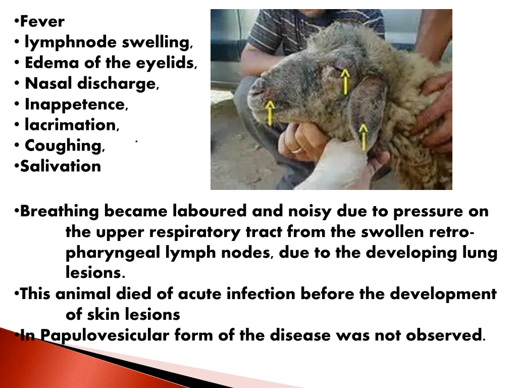 fever lymphnode swelling edema of the eyelids