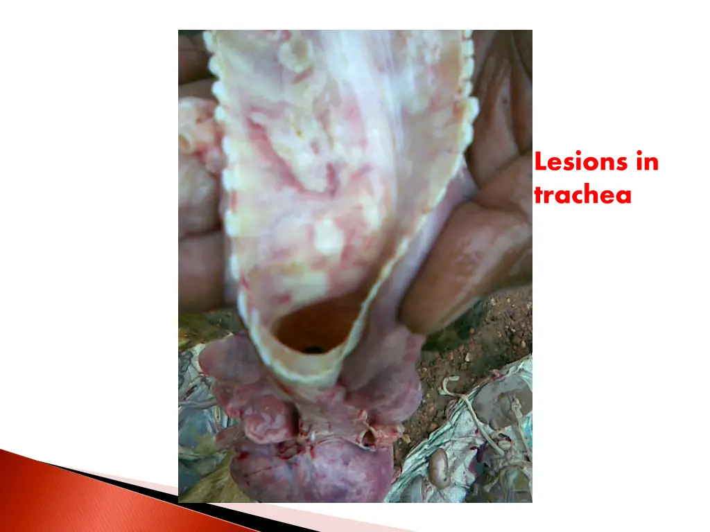 lesions in trachea