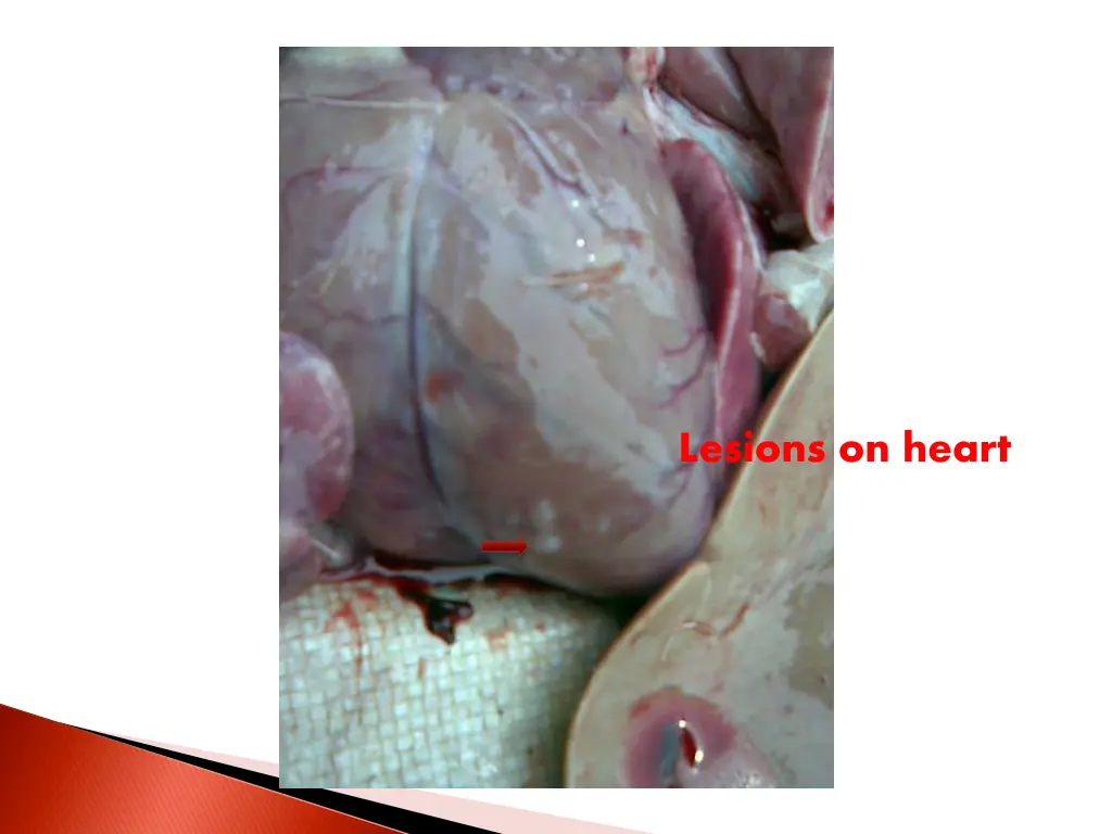 lesions on heart