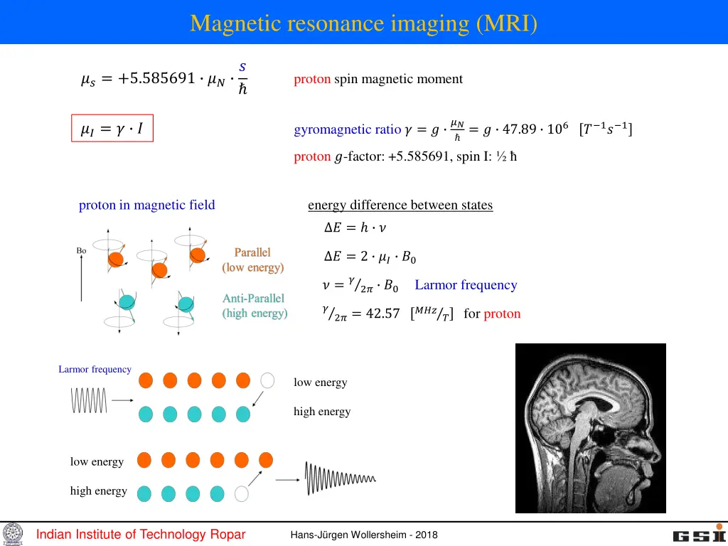 magnetic resonance imaging mri
