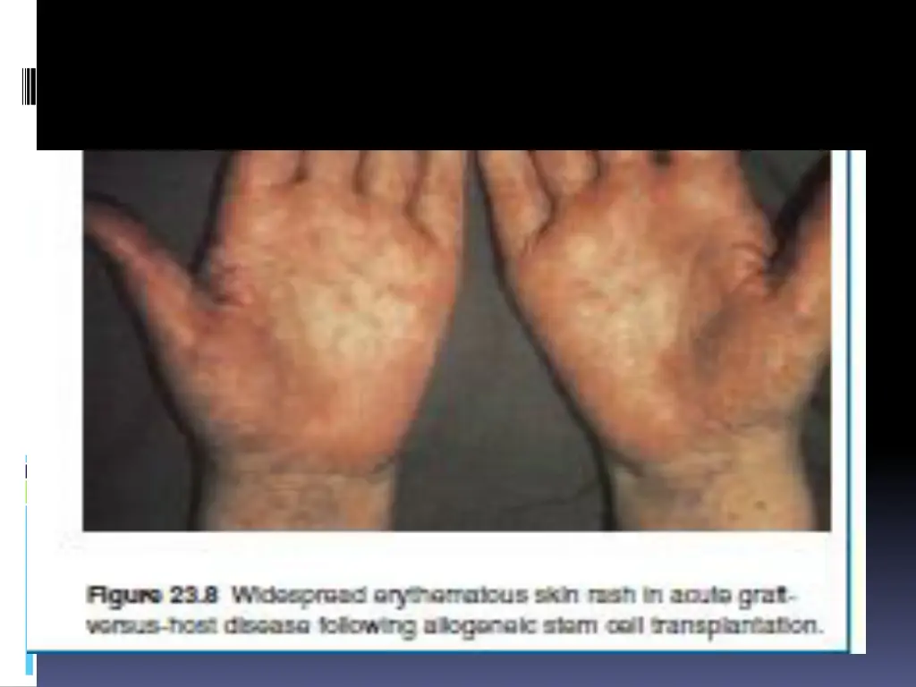 slide22