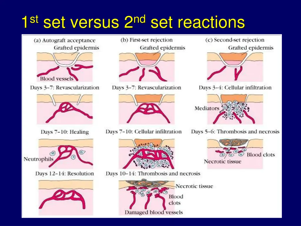 1 st set versus 2 nd set reactions