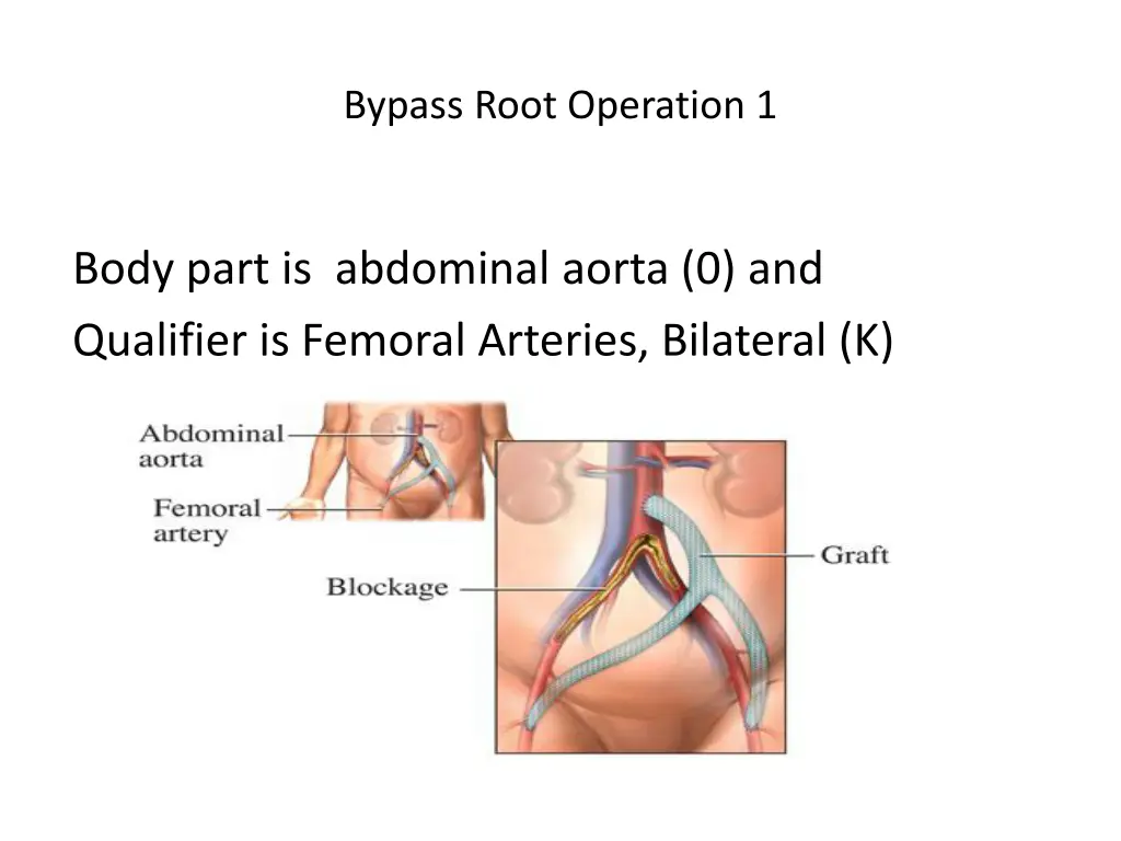 bypass root operation 1 4