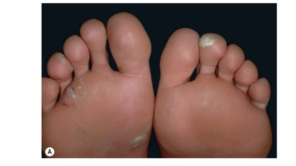 slide28