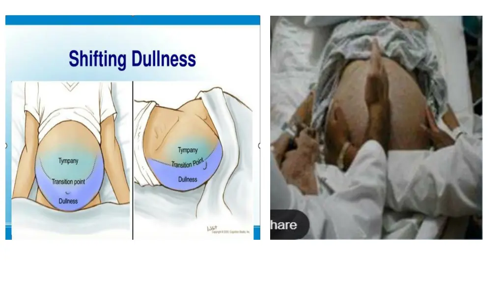 slide12