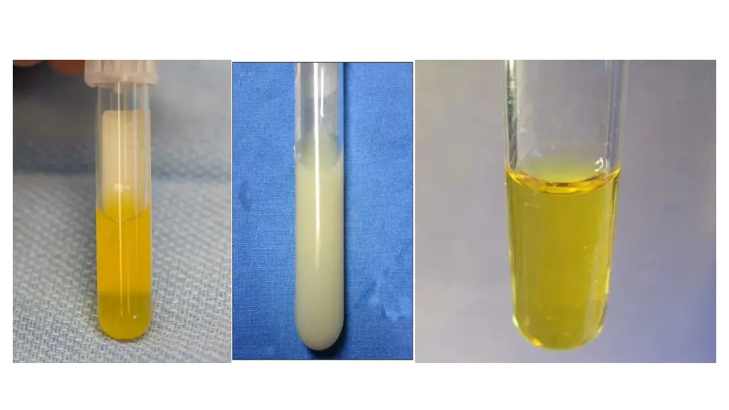 slide18