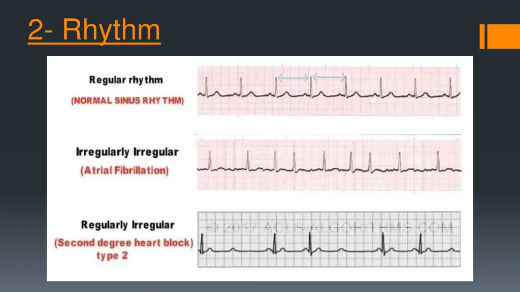 2 rhythm