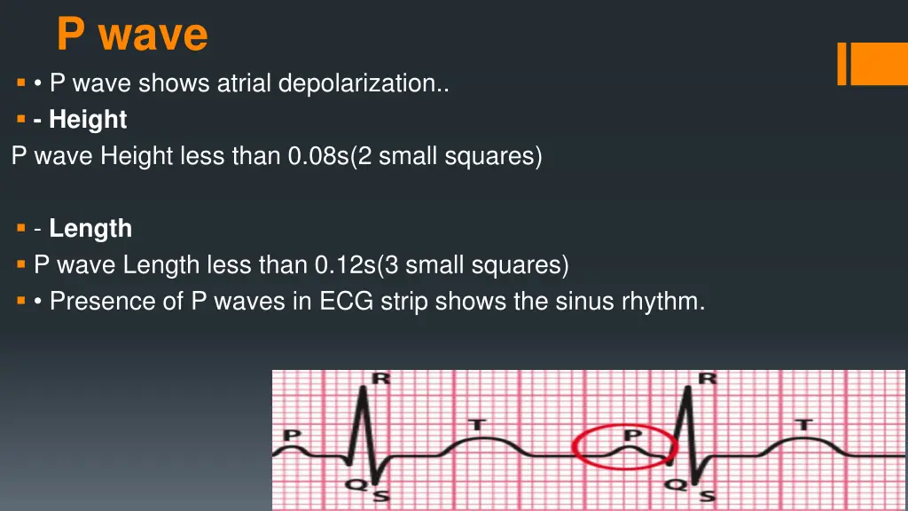 p wave p wave shows atrial depolarization height