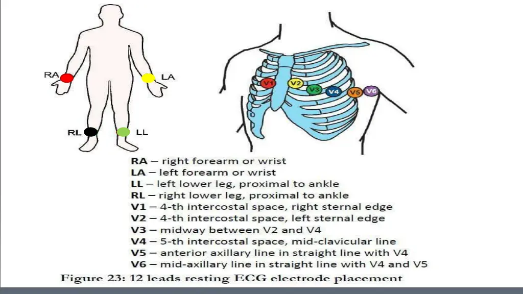 slide15