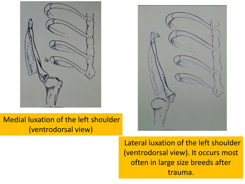 medial luxation of the left shoulder ventrodorsal