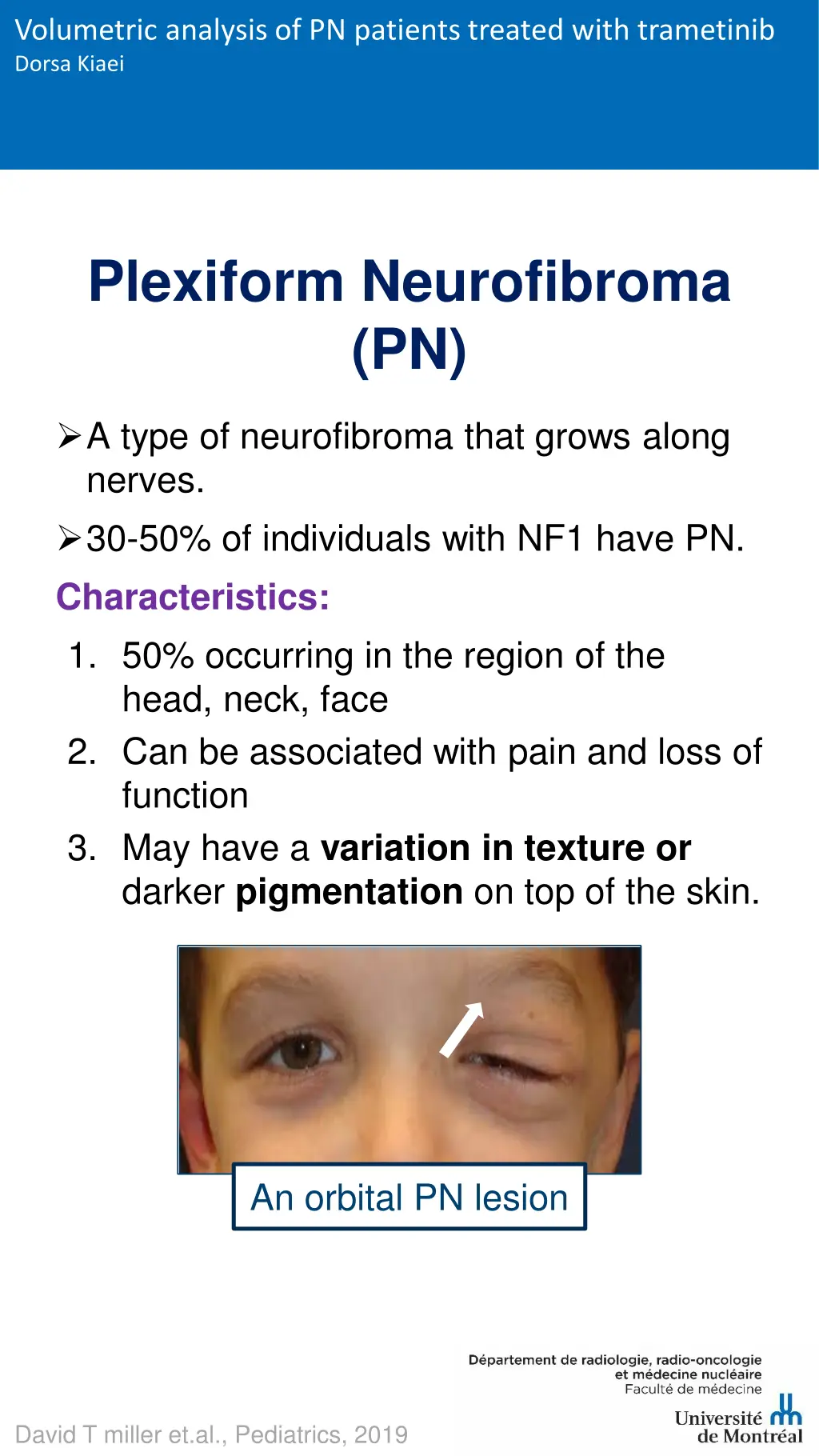 volumetric analysis of pn patients treated with 1