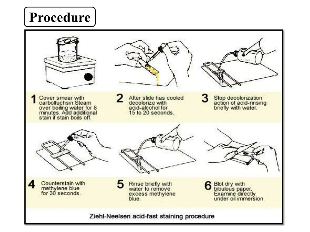 slide10
