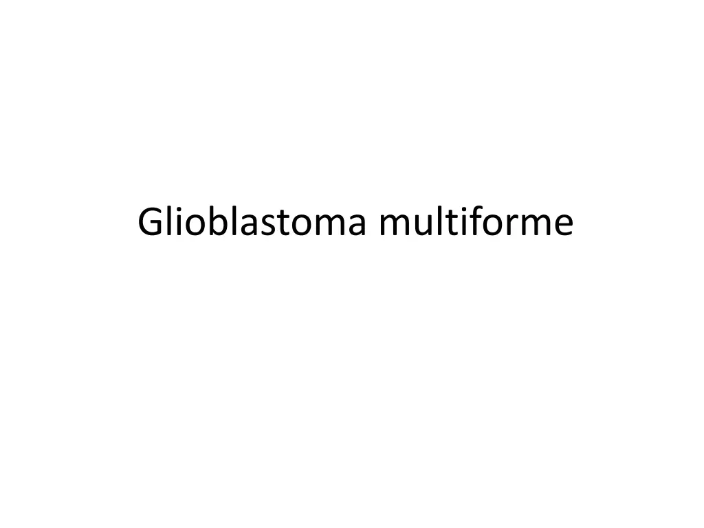 glioblastoma multiforme