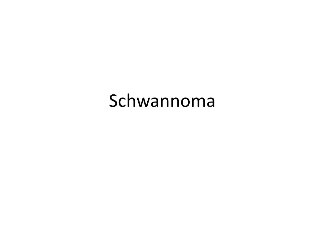 schwannoma