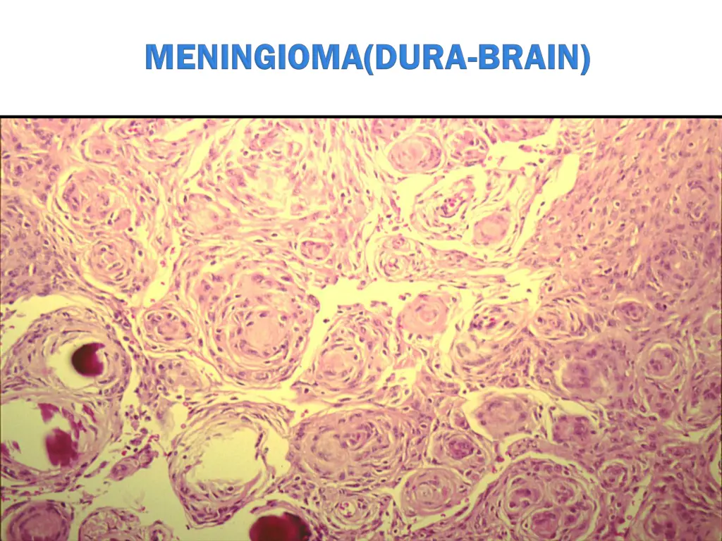 slide15