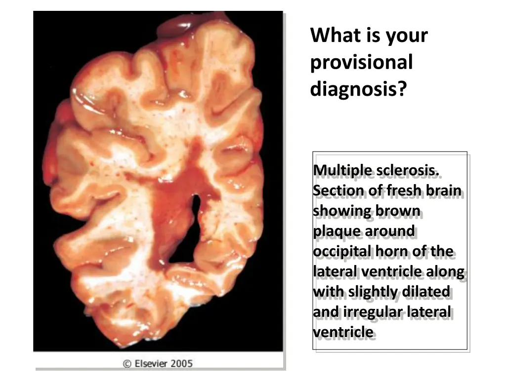 what is your provisional diagnosis