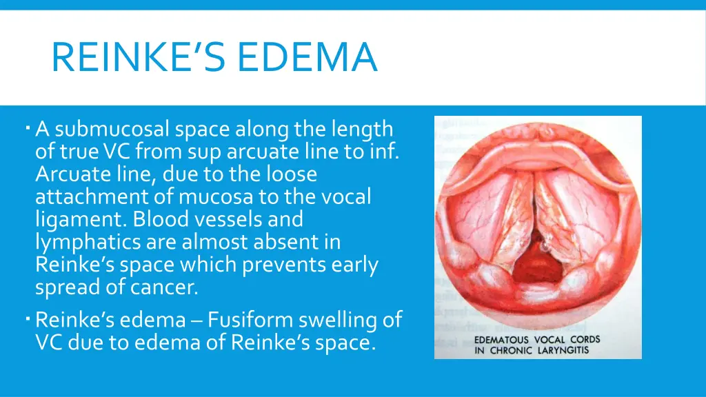 reinke s edema
