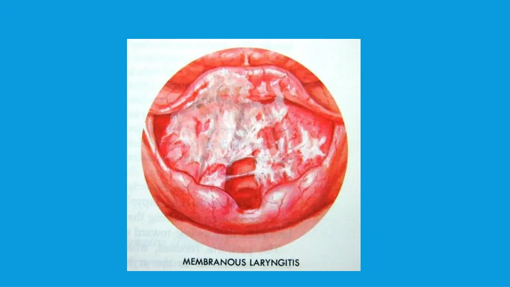 slide22