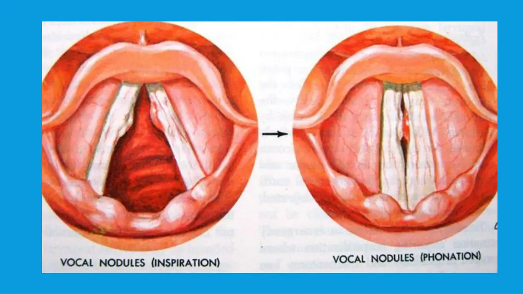 slide36