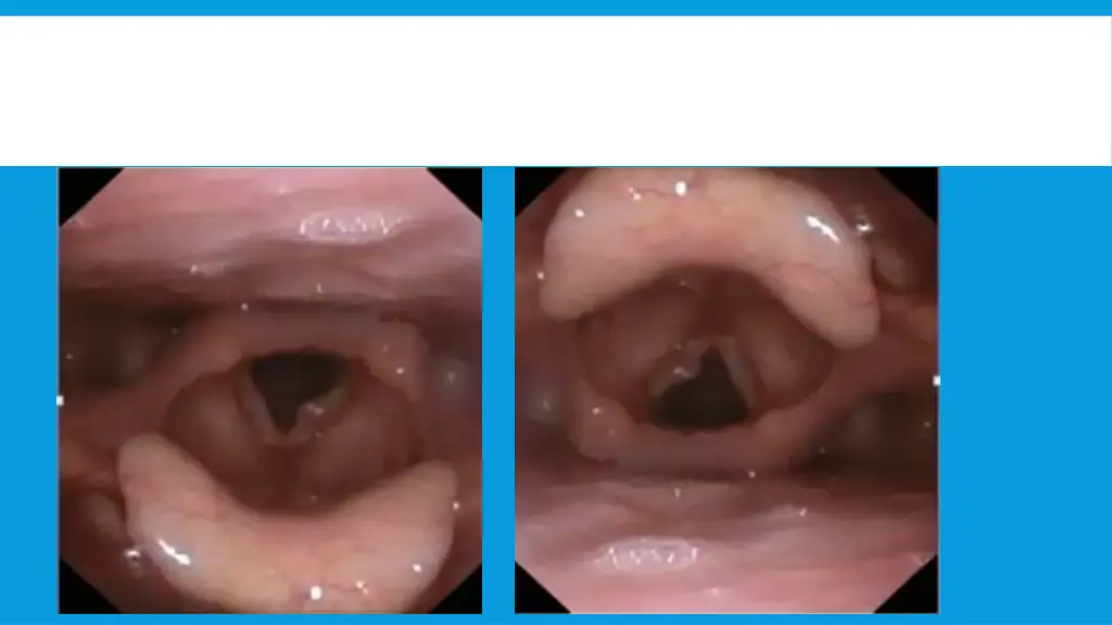 slide39