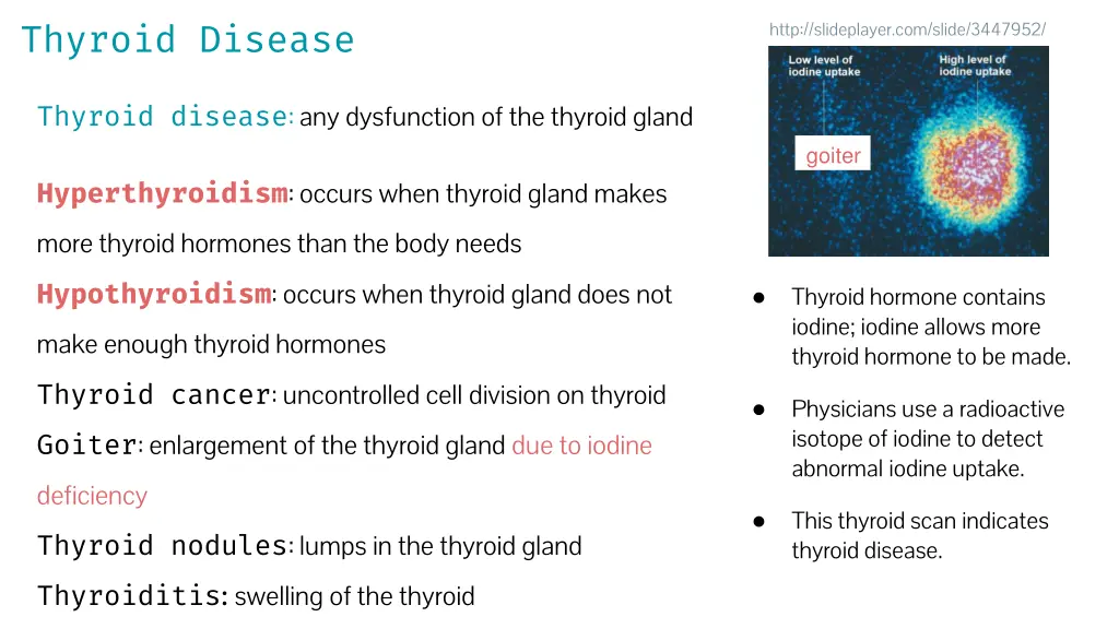 thyroid disease