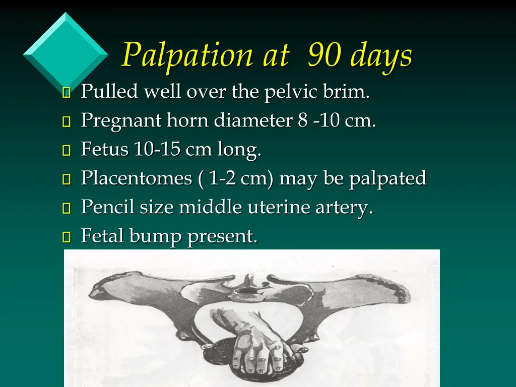 palpation at 90 days pulled well over the pelvic