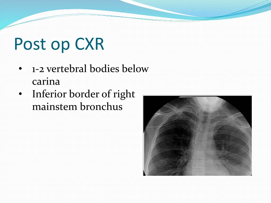 post op cxr