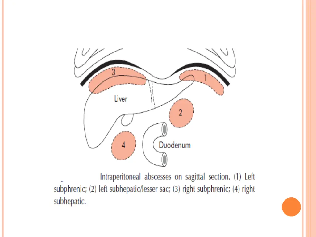 slide10