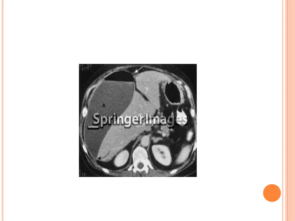 slide18