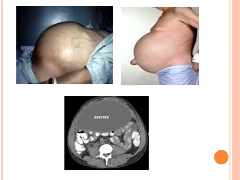 slide28