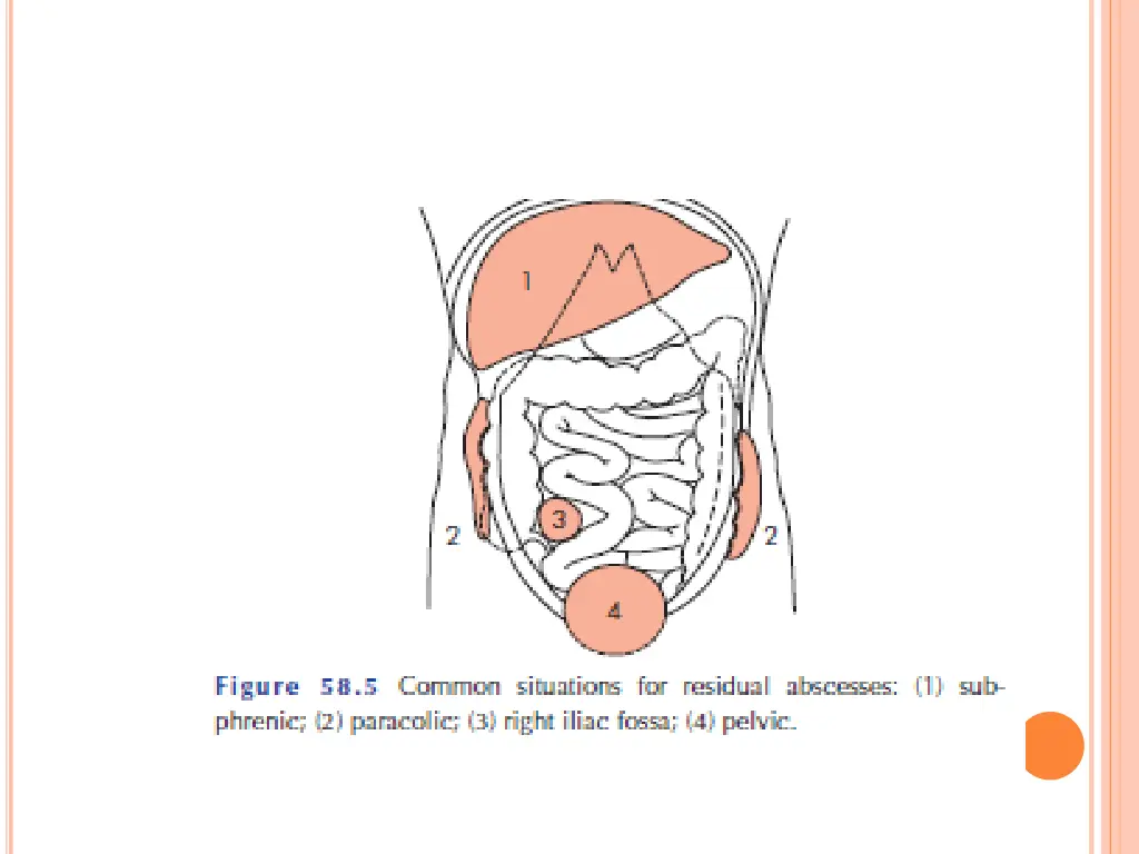 slide3